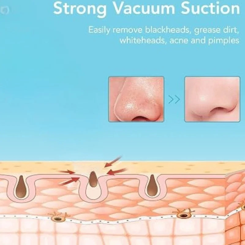 Rechargeable Blackhead Remover Vacuum Cleaner