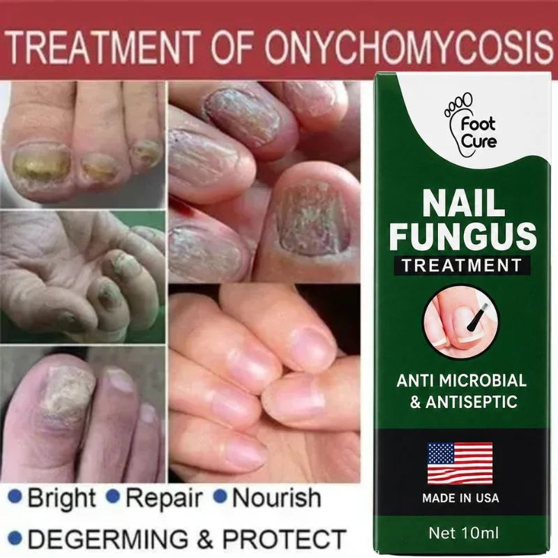Fast Nail Fungus Treatment Serum