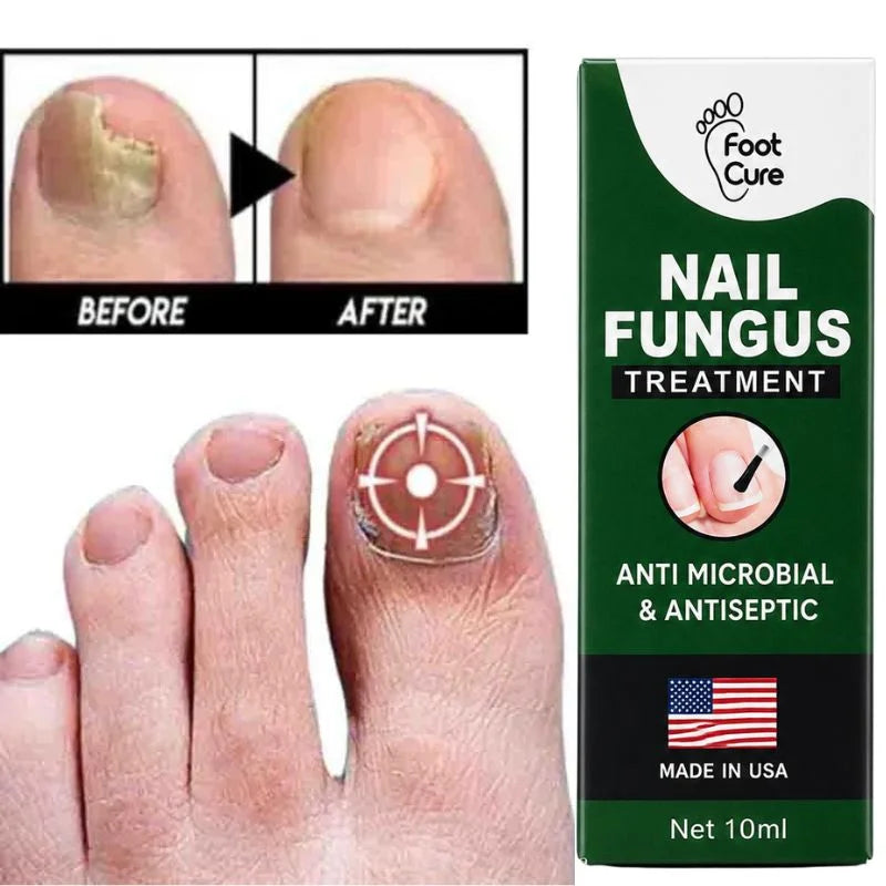 Fast Nail Fungus Treatment Serum