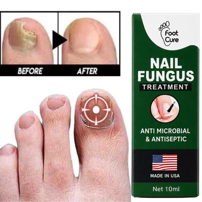 Fast Nail Fungus Treatment Serum