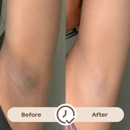 Ray Time To Shine Underarm Serum | Brightening Underarm Serum with Niacinamide
