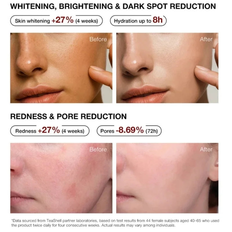 Teashell 5% Niacinamide Brightening Serum